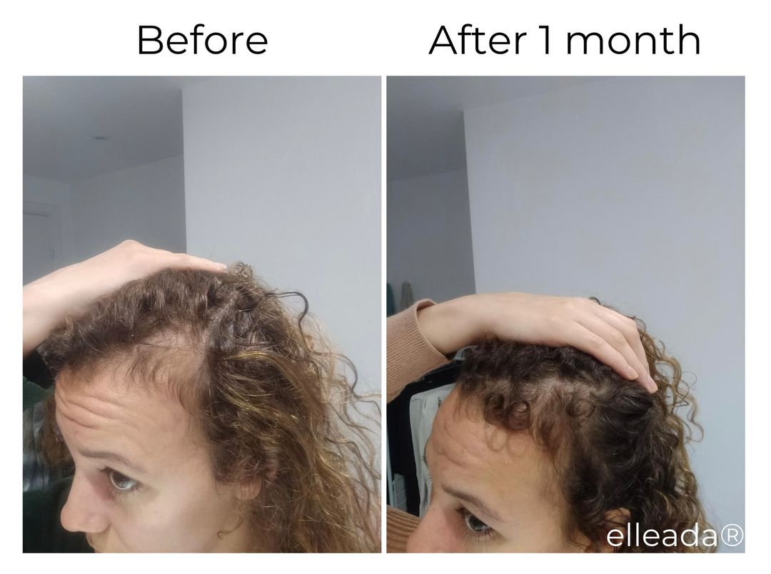 ELLEADA HAIR SERUM