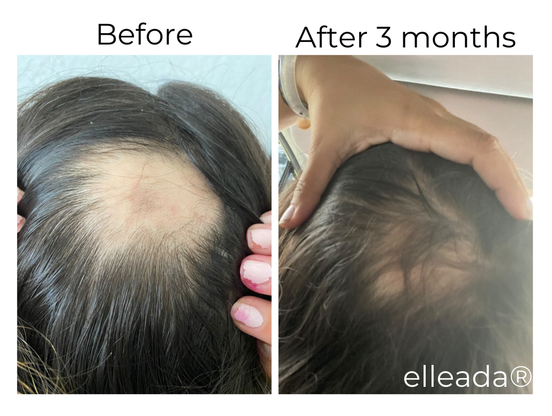 ELLEADA HAIR SERUM