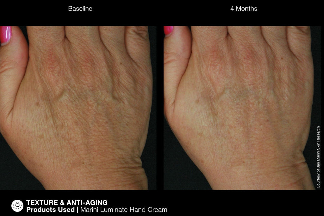 JAN MARINI RENU CORRECTIVE HAND COMPLEX